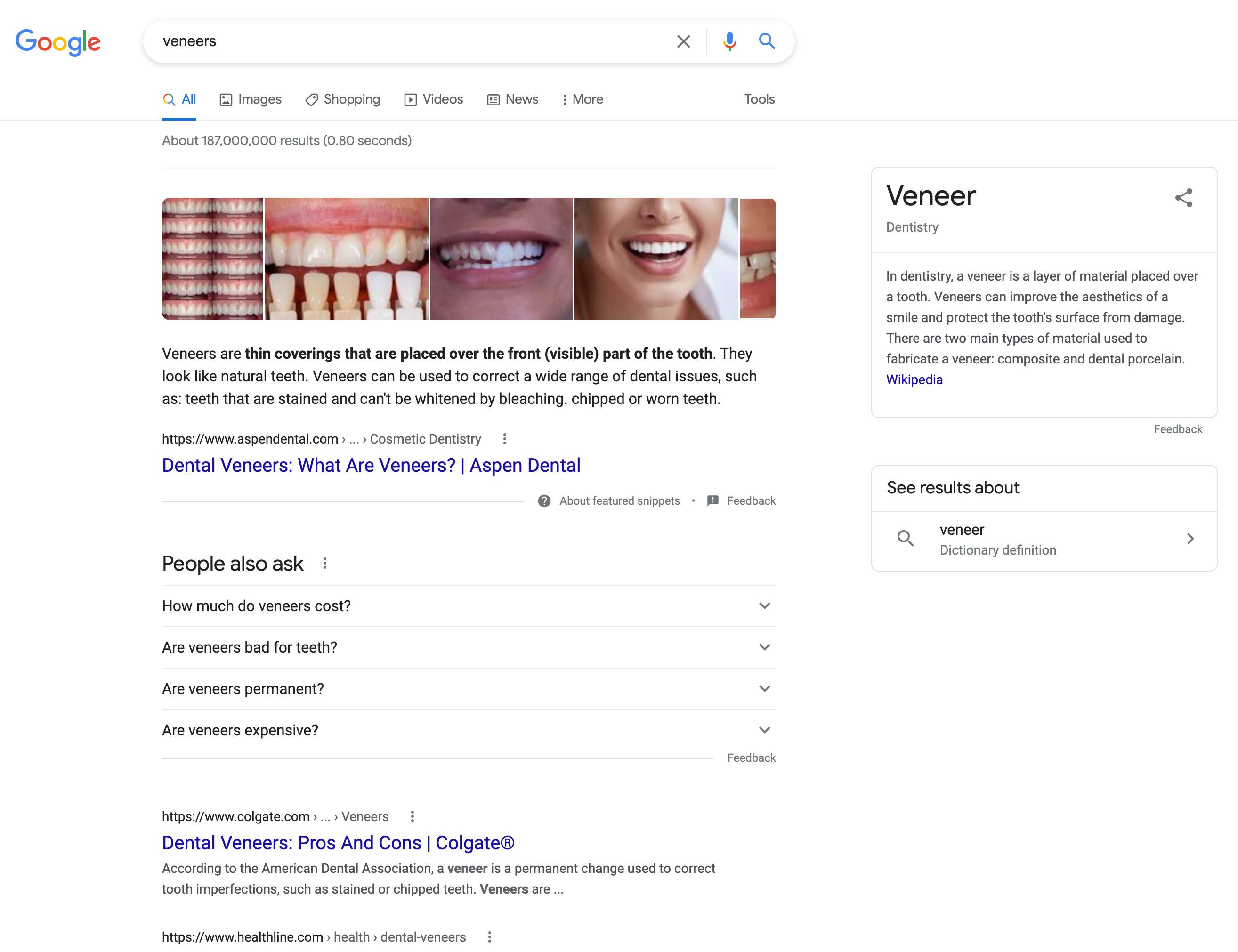 Informational keyword: “Veneers”